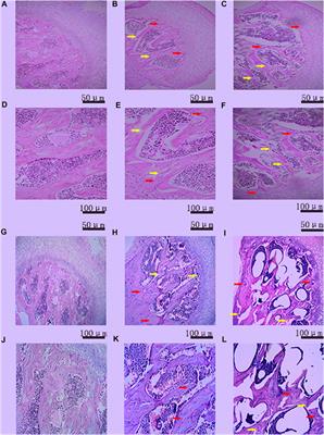 Effects of angiotensin II combined with asparaginase and dexamethasone on the femoral head in mice: A model of steroid-induced femoral head osteonecrosis